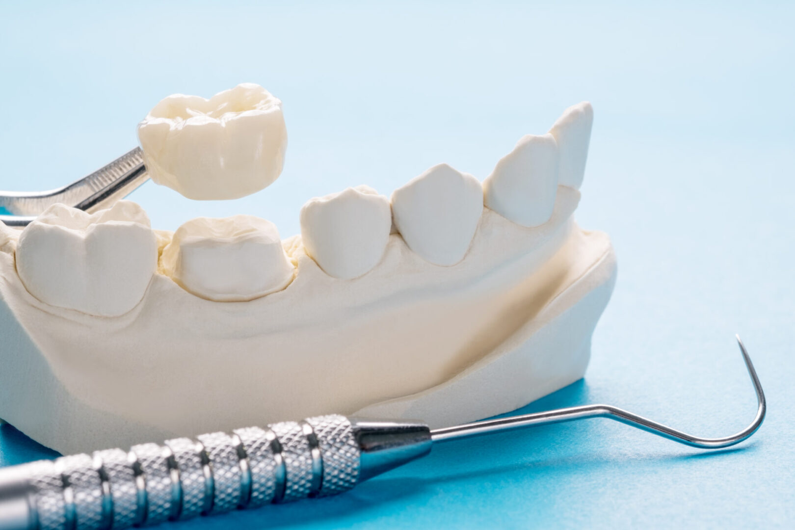 A dental model with a tooth brush and paste